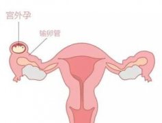жûѪأ