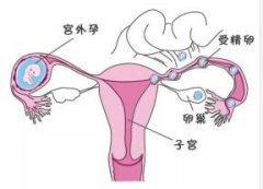 ϴ裿